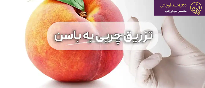 تزریق چربی به باسن چیست؟