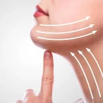 جراحی لیپوفیس