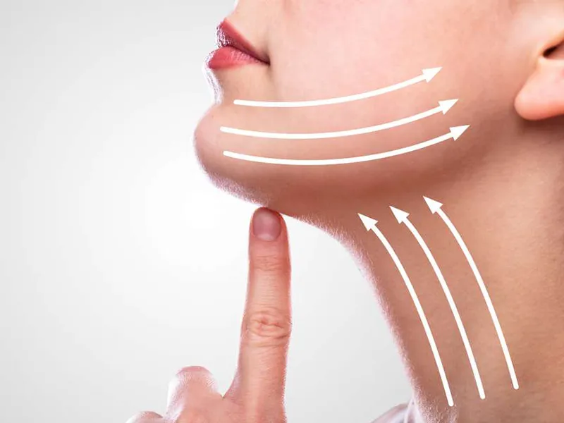 جراحی لیپوفیس