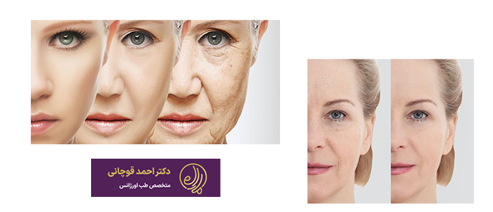 درباره تزریق چربی صورت
