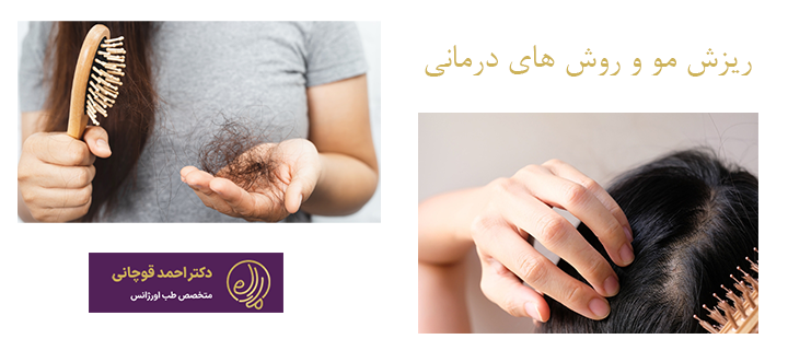 درباره ریزش مو و روش های درمانی