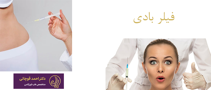 فیلر بادی چیست؟