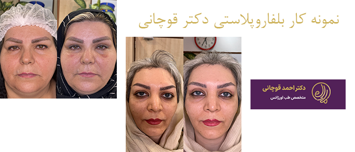 نمونه کار بفاروپلاستی 