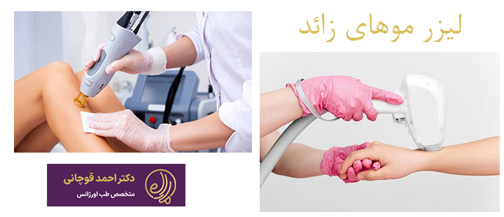 درباره لیزر موهای زائد 