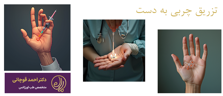 درباره تزریق چربی به دست