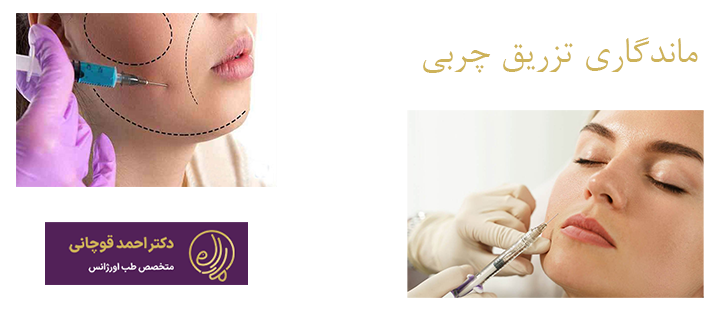 درباره ماندگاری تزریق چربی