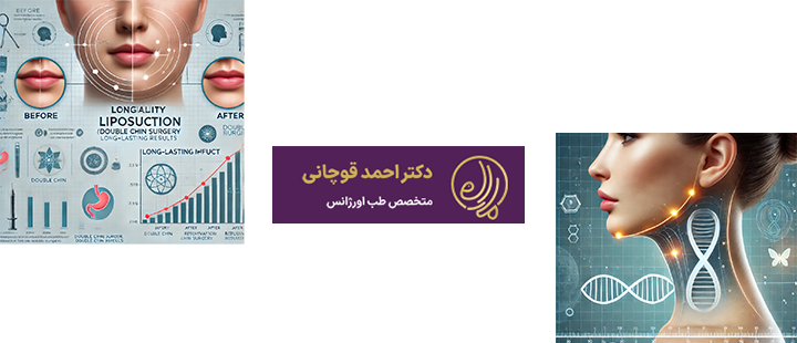 آشنایی با ماندگاری ساکشن غبغب 