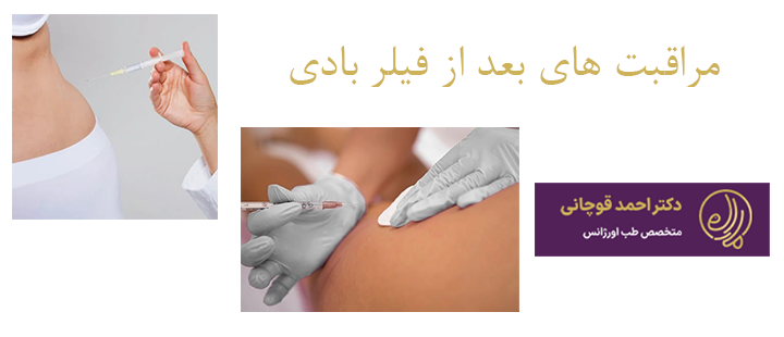 درباره مراقبت های بعد از فیلر بادی 