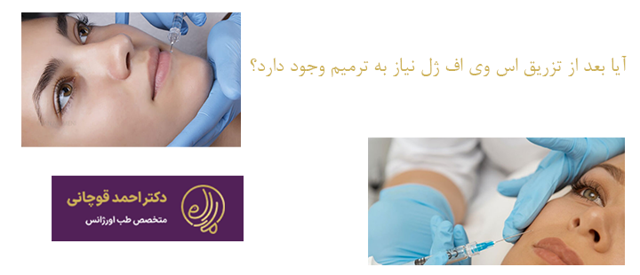آیا بعد از تزریق اس وی اف ژل نیاز به ترمیم وجود دارد؟