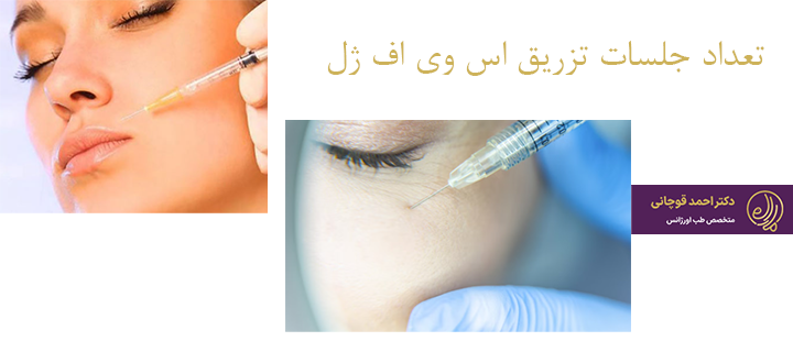 تعداد جلسات مورد نیاز برای تزریق اس وی اف ژل