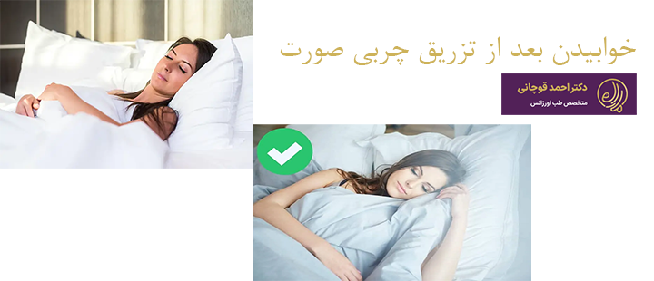 درباره خوابیدن بعد تزریق چربی صورت 