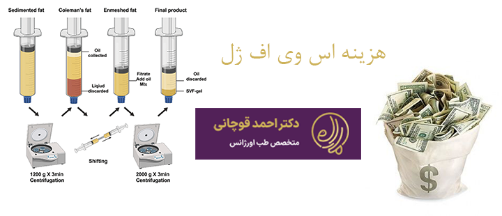 درباره هزینه اس وی اف ژل