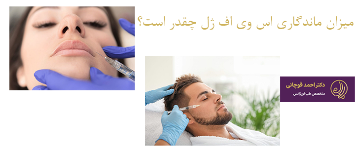 ماندگاری اس وی اف ژل چقدر است؟