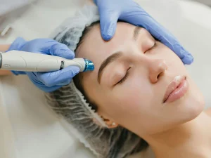 مراقبت های بعد از تزریق ژل جالپرو