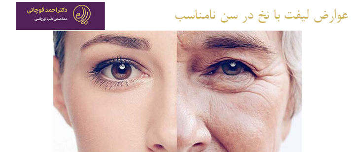 عوارض لیفت با نخ در سن نامناسب
