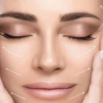 مراقبت های بعد از اس وی ژل