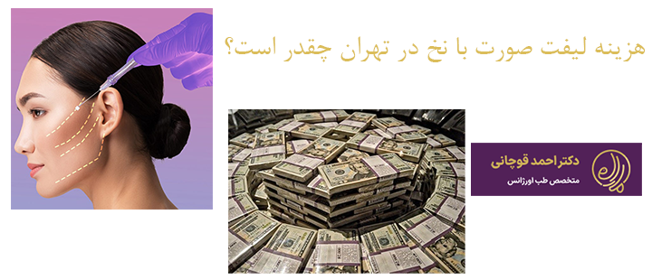 هزینه لیفت صورت با نخ در تهران چقدر است؟