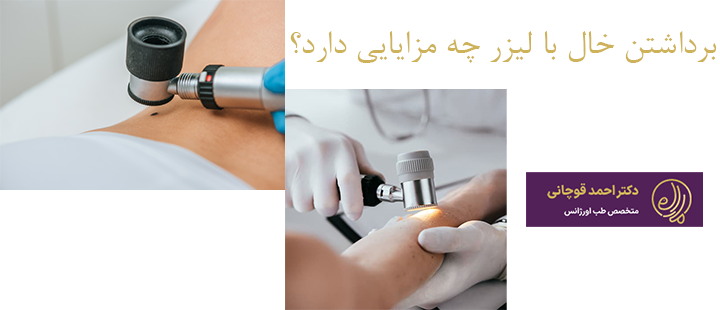 برداشتن خال با لیزر چه مزایایی دارد؟