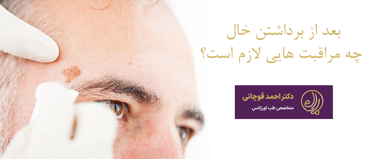 بعد از برداشتن خال چه  مراقبت هایی لازم است؟