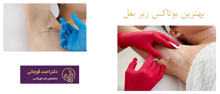بهترین بوتاکس زیر بغل 