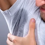 بوتاکس زیربغل