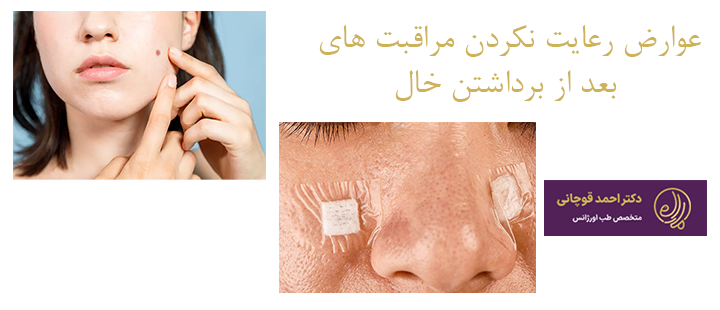 عوارض رعایت نکردن مراقبت‌های بعد از برداشتن خال