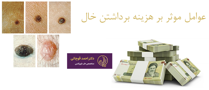 عوامل موثر بر هزینه برداشتن خال 