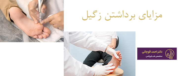 مزایای برداشتن زگیل
