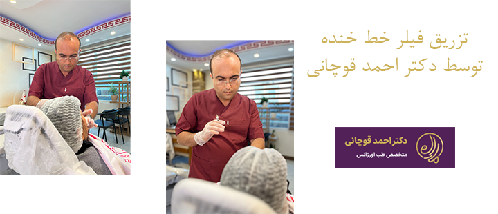 تزریق فیلر خط خنده توسط دکتر احمد قوچانی