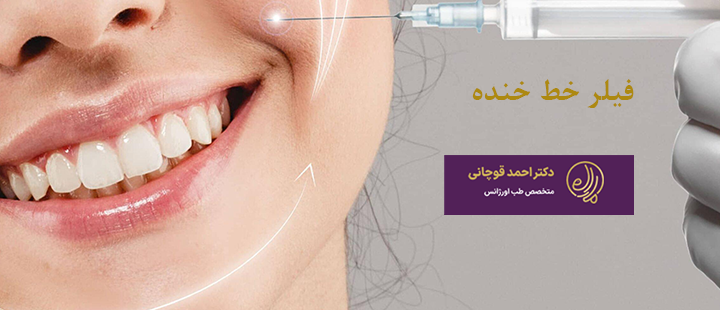 فیلر خط خنده چیست؟