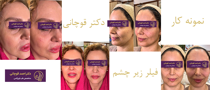 نمونه کار دکتر قوچانی 