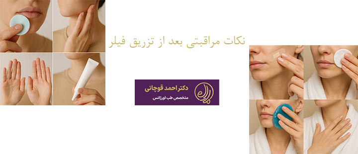 نکات مراقبتی بعد از تزریق فیلر