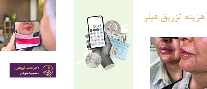 هزینه تزریق فیلر چقدر است؟