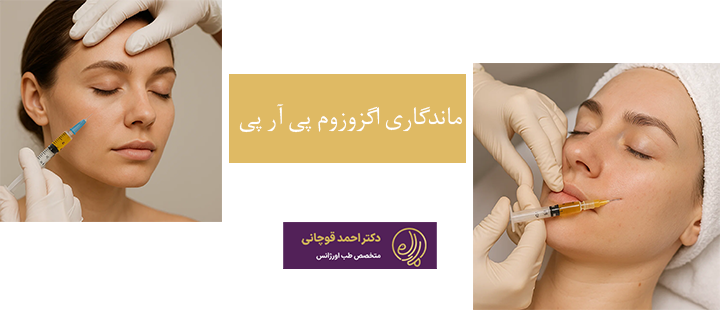 ماندگاری اگزوزوم پی آر پی