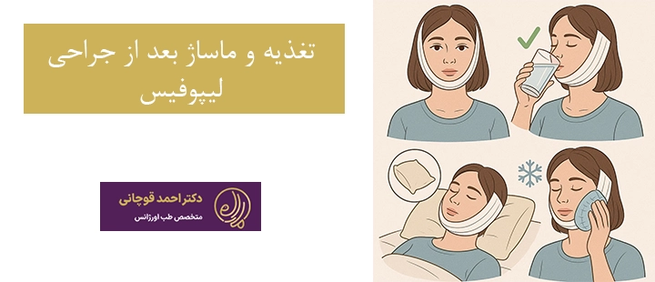 تغذیه و ماساژ بعد از لیپوفیس