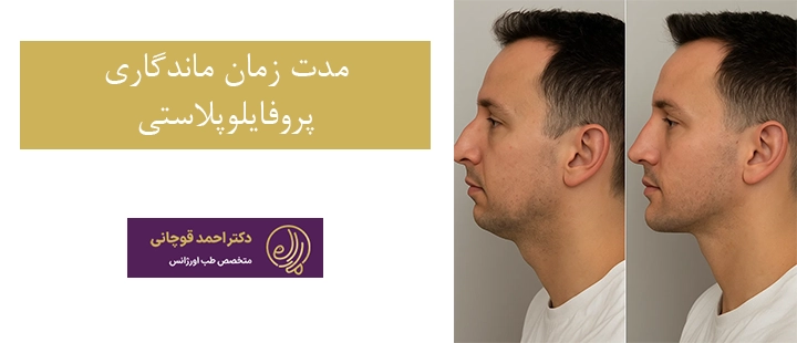 مدت زمان ماندگاری پروفایلوپلاستی 