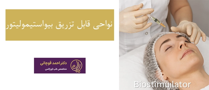نواحی مورد نیاز برای تزریق بیواستیمولیتور 