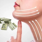 هزینه لیپوفیس