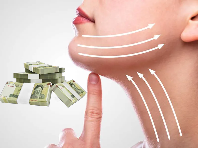هزینه لیپوفیس