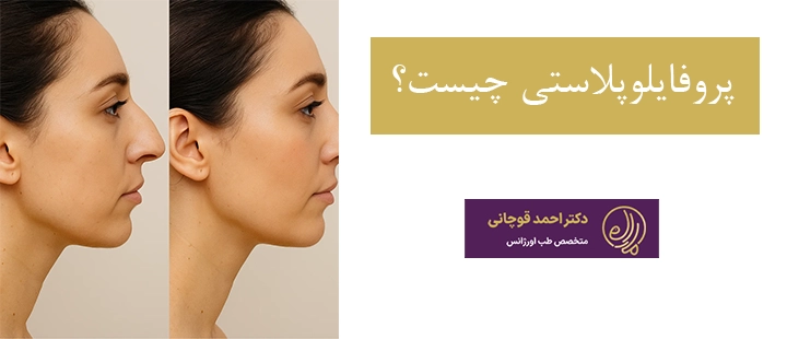 پروفایلوپلاستی چیست؟