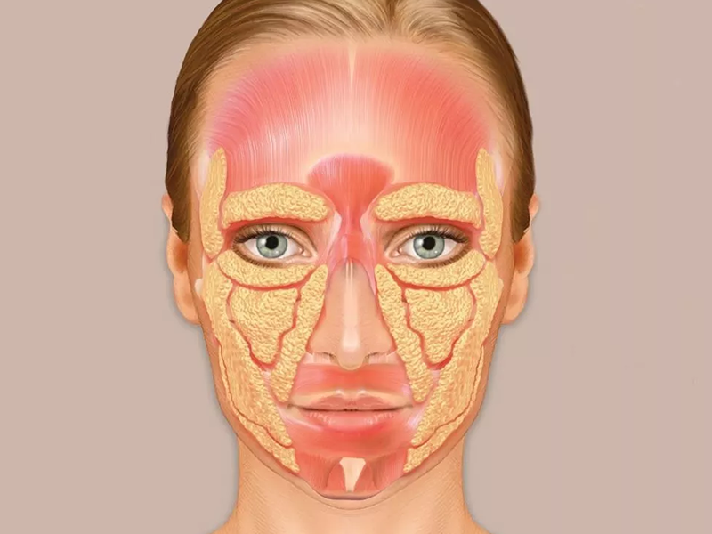 درباره سندرم پرشدگی صورت