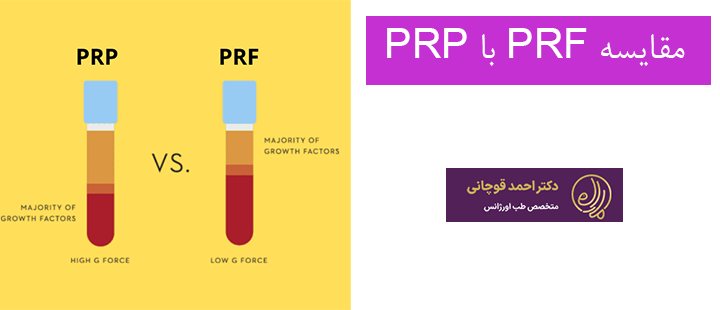 مقایسه PRF با PRP