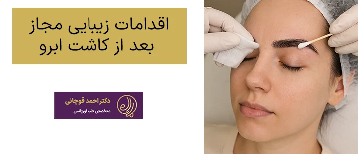 اقدامات مجاز بعد از کاشت ابرو