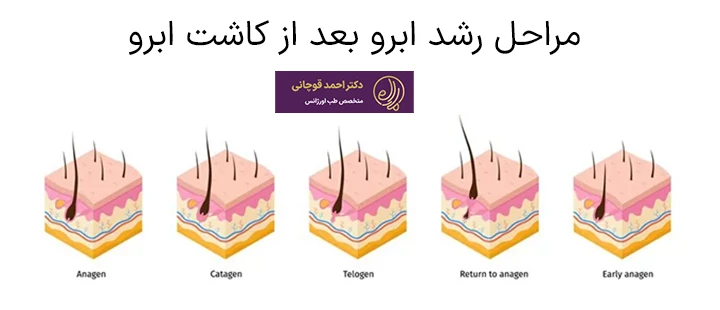 مراحل رشد ابرو بعد از کاشت ابرو