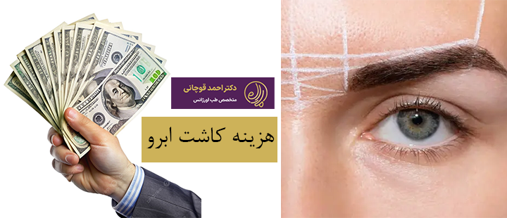 هزینه کاشت ابرو چقدر است؟