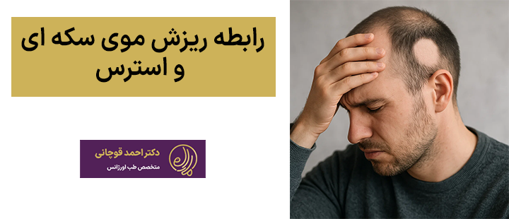رابطه ریزش موی سکه ای و استرس