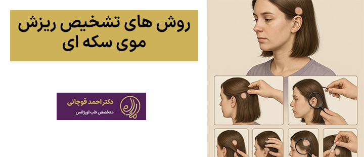 روش های تشخیص ریزش موی سکه ای