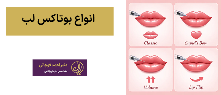 انواع بوتاکس لب