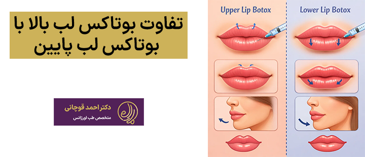 تفاوت بوتاکس لب بالا با لب پایین
