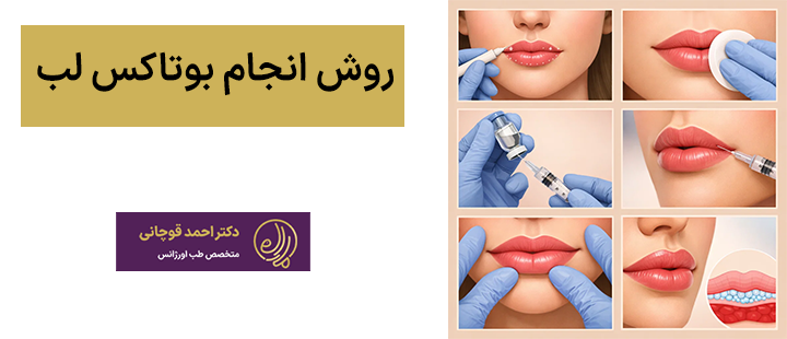 روش انجام بوتاکس لب
